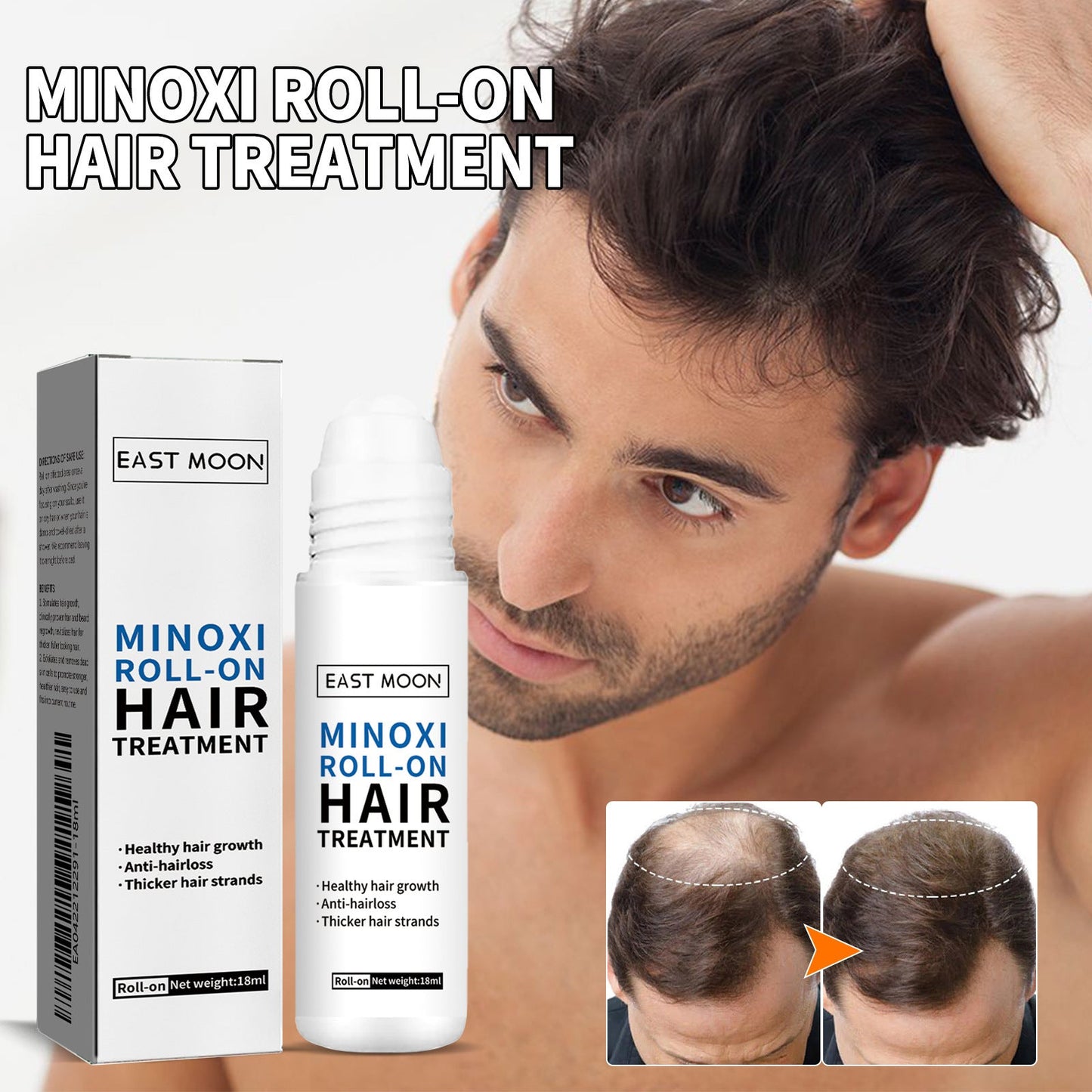 🌿EAST MOON Minoxi Roll-On Hair Treatment|Buy 1 Get 1 Free🔥