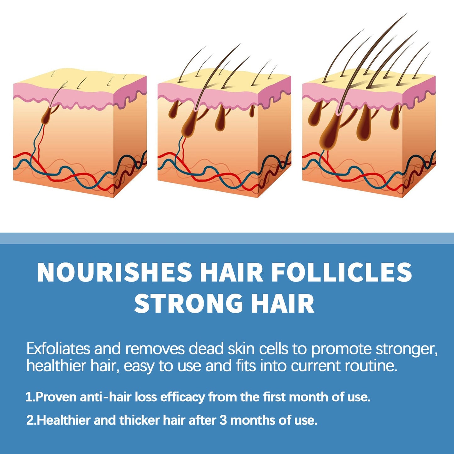 🌿EAST MOON Minoxi Roll-On Hair Treatment|Buy 1 Get 1 Free🔥