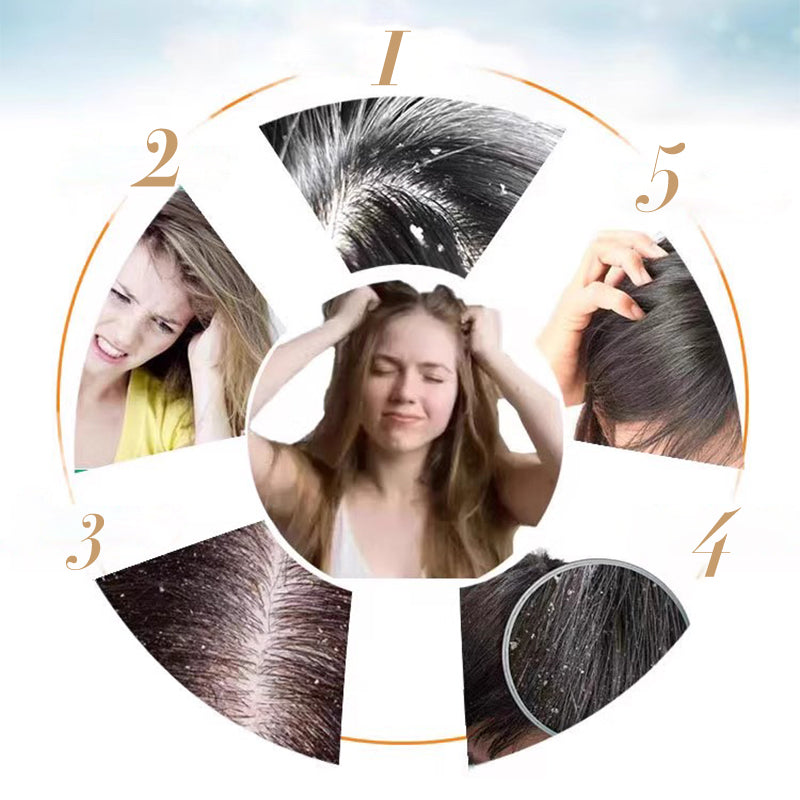Summer Sale - New Products 50% OFF! 🔥🍃 Anti-Dandruff Refreshing Shampoo