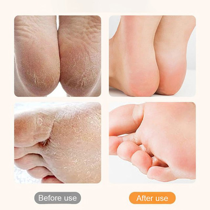 Rechargeable Electric Foot Exfoliating Scrubber