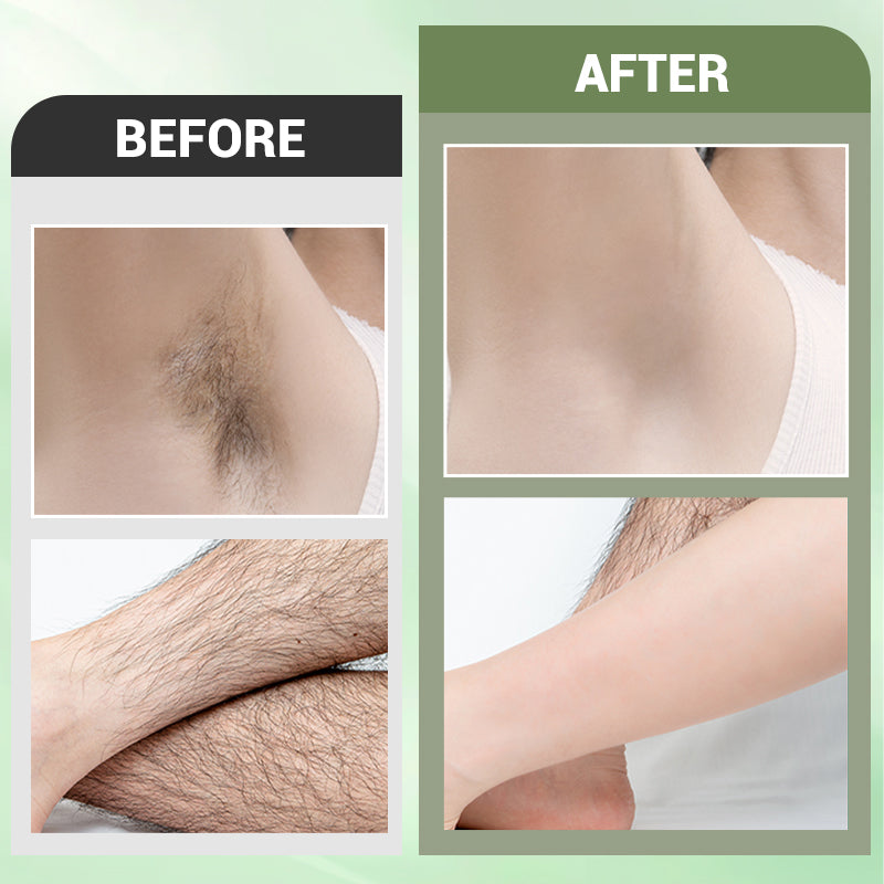 🌸Early Spring Perks🌸Hair Removal Cream Set for Full Body