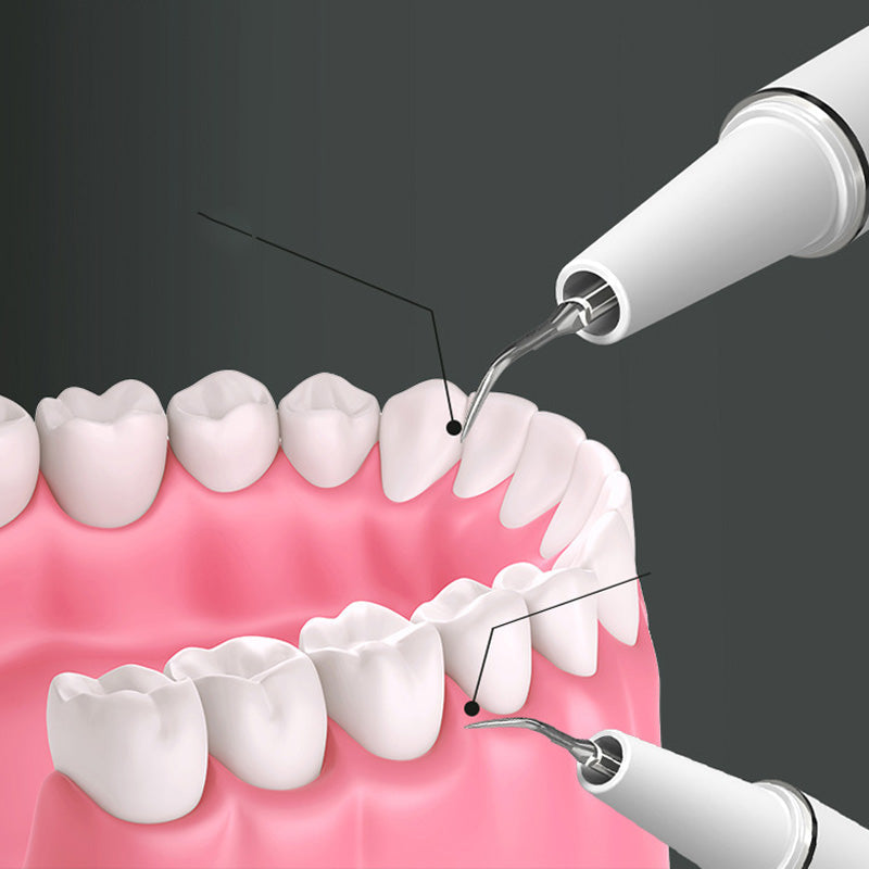 ✨😁🦷✨ Highly Effective Portable Ultrasonic Dental Cleaner - 360° Dental Care at Home! 🚿🦷🌿