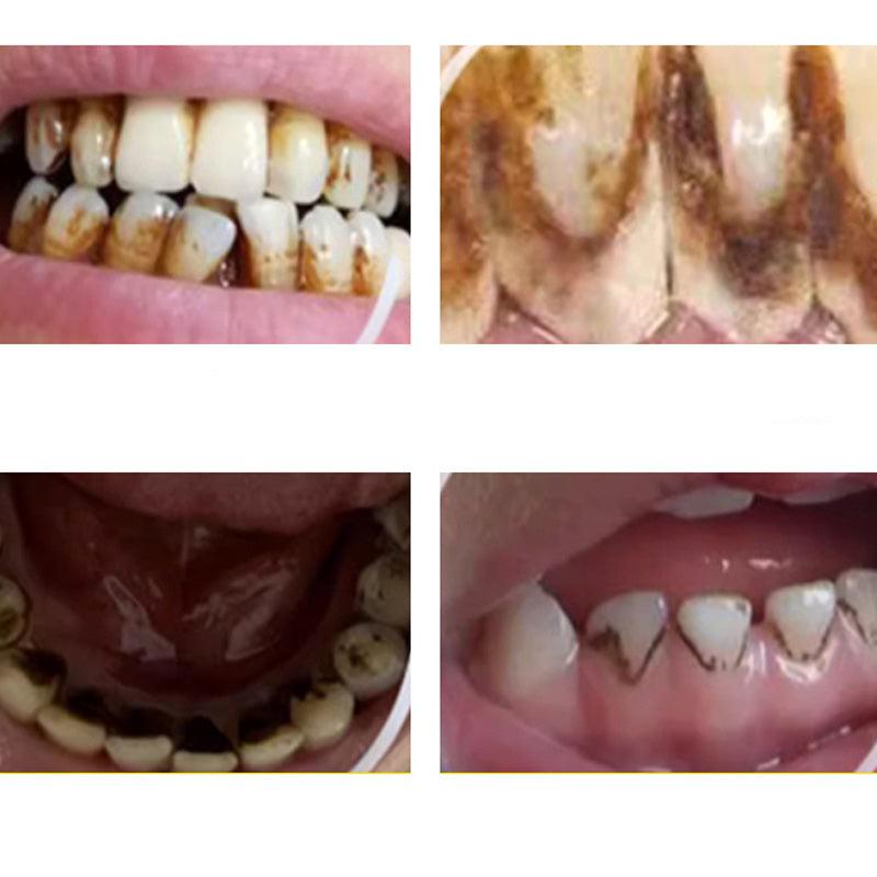 ✨😁🦷✨ Highly Effective Portable Ultrasonic Dental Cleaner - 360° Dental Care at Home! 🚿🦷🌿