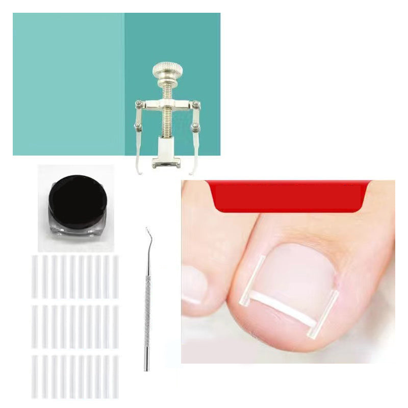 đ„LIMITED OFFERđ„Ingrown Toenail Treatment Corrector Set