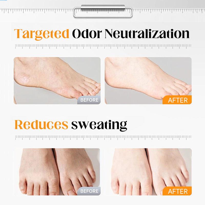 🌿Natural Foot Deodorant Spray- Stay Fresh All Day! 👟✨