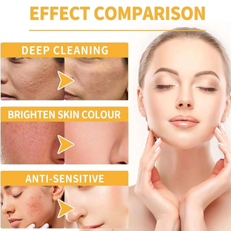 ✨ Peel Shot Keratin Care – Kojic Acid & Turmeric Brightening Spray 🌿