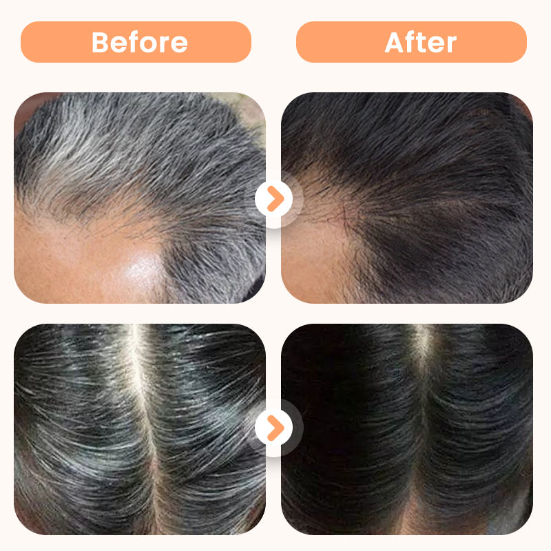 💆♀️🌿Plant Extract Hair Dye for Gray Hair