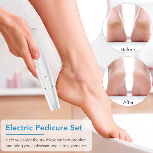 🔥LAST DAY SALE 49% OFF🔥Electric Feet Callus Remover⚡
