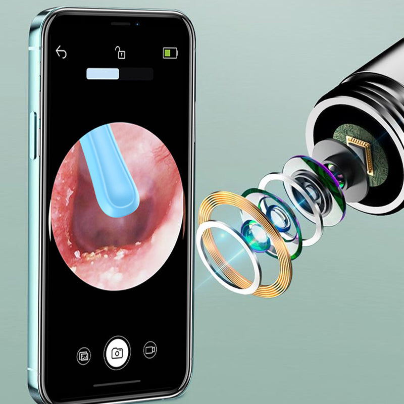 🏆Hot Sale👂Visualized Electric Ear Wax Removal Tool
