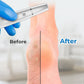 🔥Hot Sale - 50% OFF🔥Electric Feet Callus Remover⚡🌸