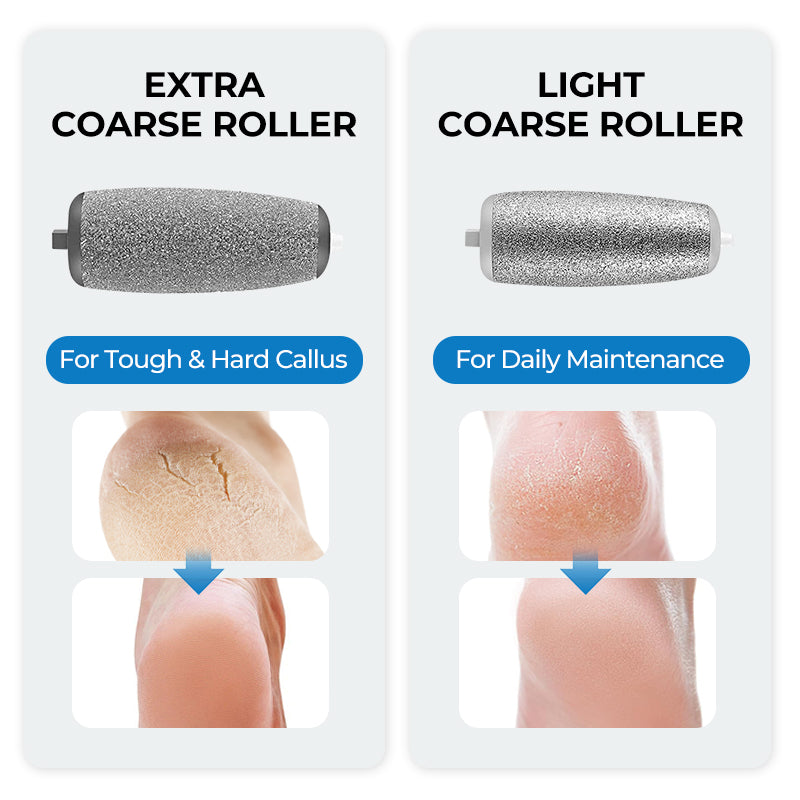 🔥Hot Sale - 50% OFF🔥Electric Feet Callus Remover⚡🌸