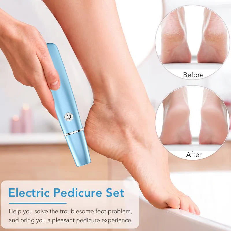 🔥Hot Sale - 50% OFF🔥Electric Feet Callus Remover⚡🌸