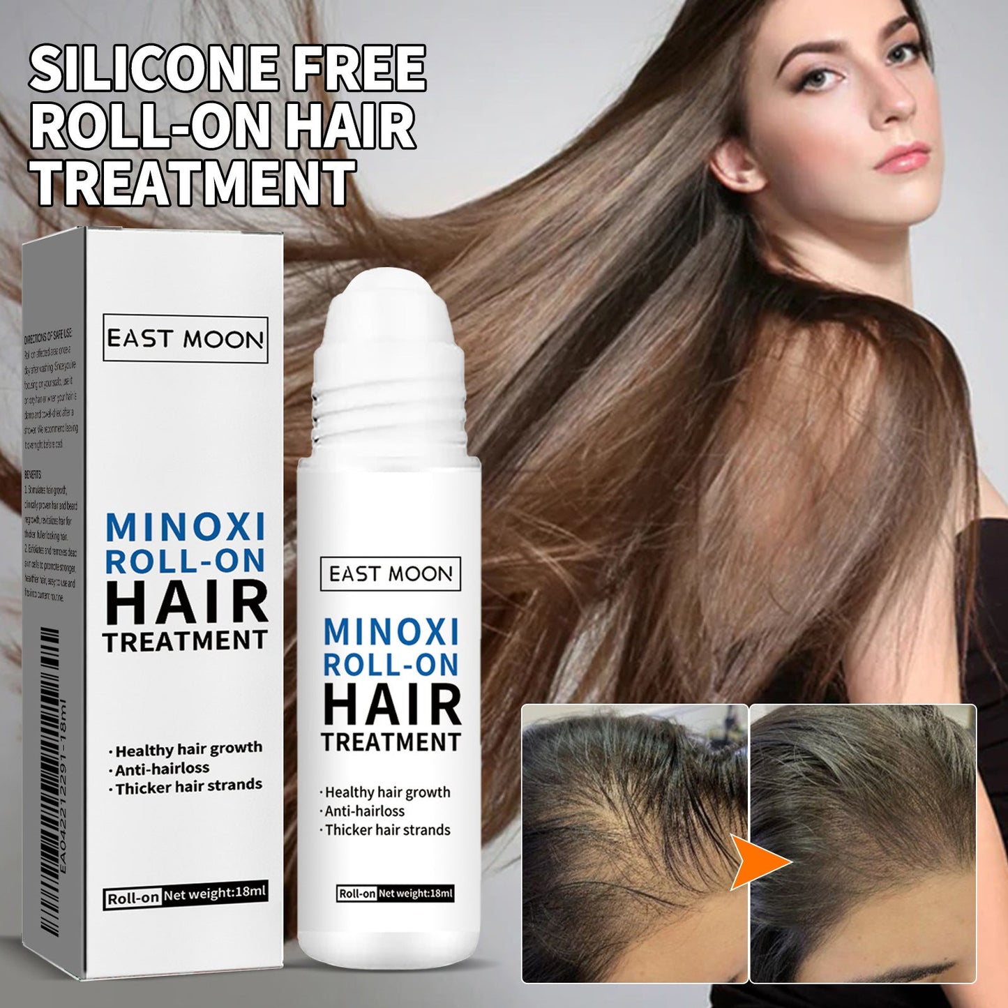 🌿EAST MOON Minoxi Roll-On Hair Treatment|Buy 1  Get 1 Free🔥