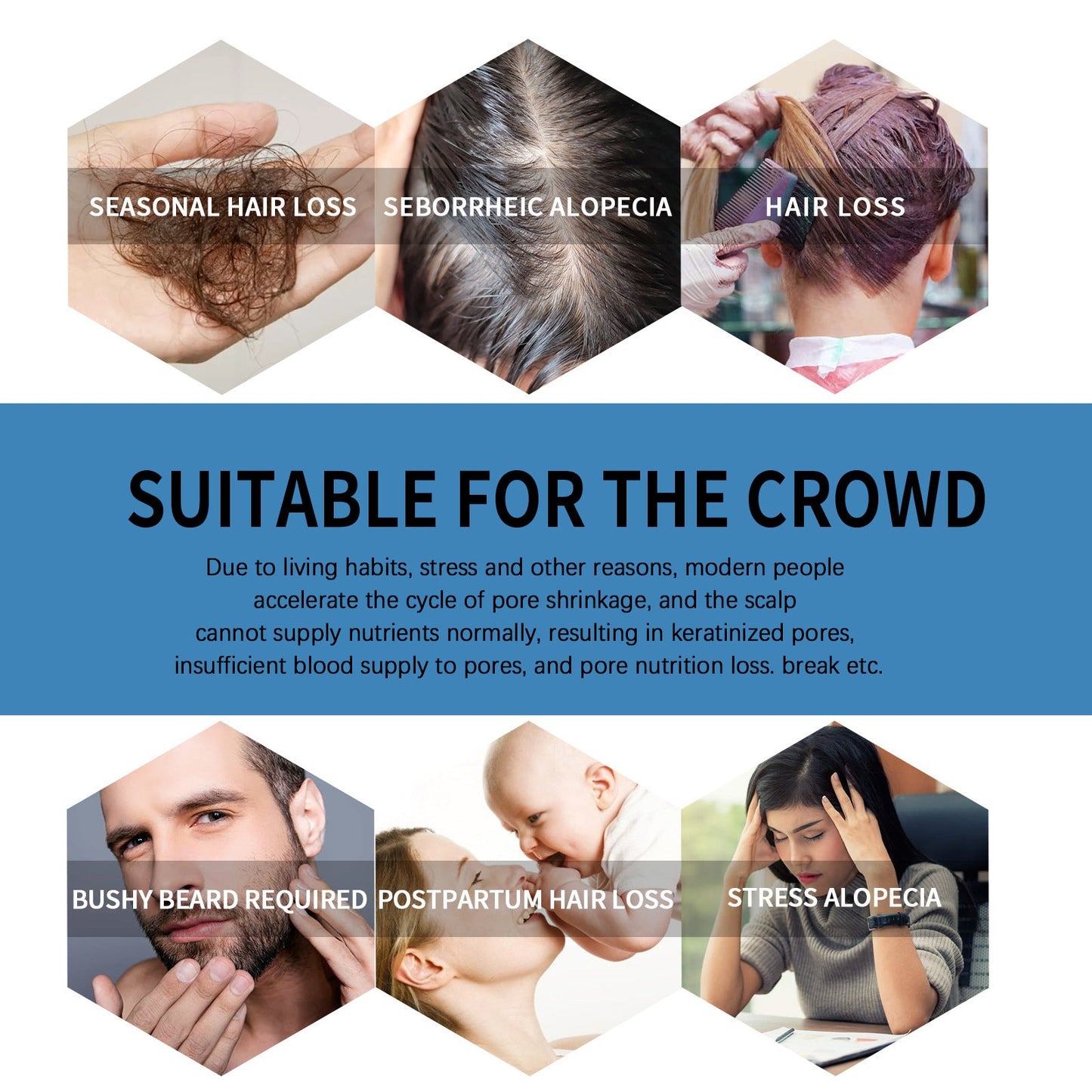 🌿EAST MOON Minoxi Roll-On Hair Treatment|Buy 1  Get 1 Free🔥