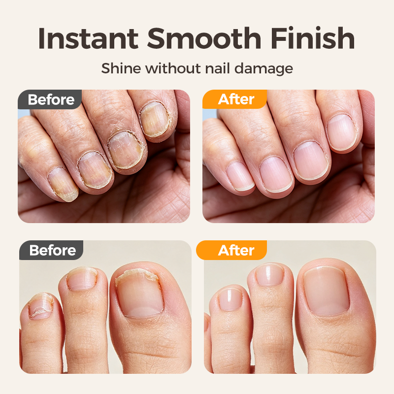 ✂️ 2-in-1 Smart Electric Nail Clipper & Polisher – Anti-Pinch Safety & LED Light 💅
