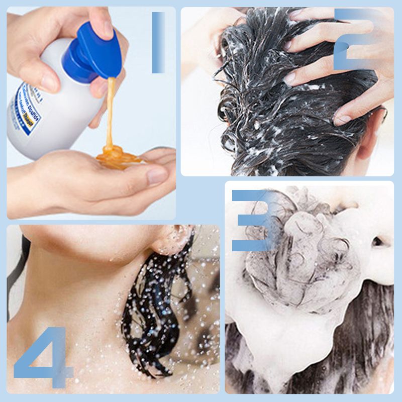 🌿Selenium Disulfide Anti-dandruff Shampoo 🌟Dandruff & Itch Relief, Oil Control 🌟