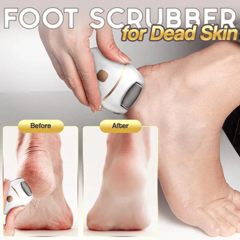 ⏳ Limited-time offer⏳ Rechargeable electric foot file for calluses Two speeds and removable grinding head USB charging Available in four colors