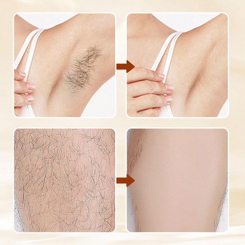 ⏳Time-Limited Special⏰Versatile Aromatic  Hair Removal Cream 💥