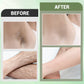 🌸Early Spring Perks🌸Hair Removal Cream Set for Full Body