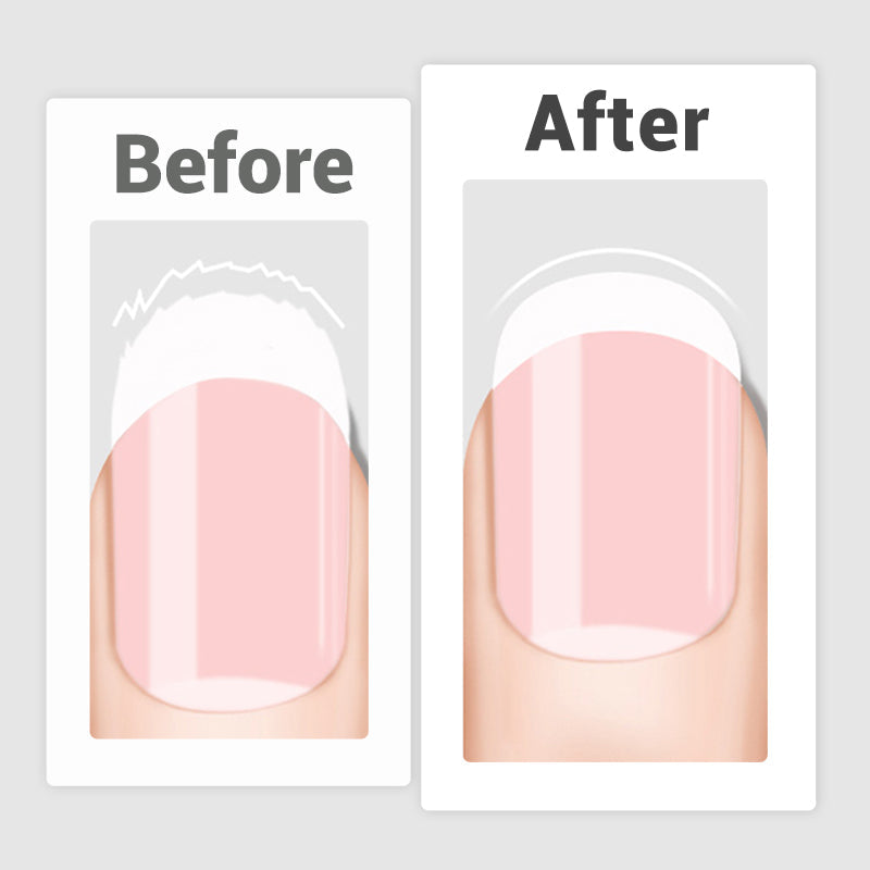 💅Buy 2 Get 1 Free💖Double Sided Stainless Steel Nail File