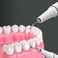 ✨😁🦷✨ Highly Effective Portable Ultrasonic Dental Cleaner - 360° Dental Care at Home! 🚿🦷🌿