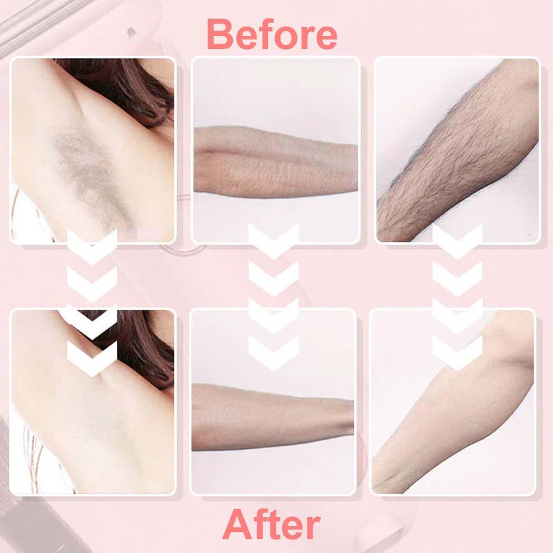 💖HOT SALE 50% OFF💖 Electric Body Hair Trimmer for Men & Women