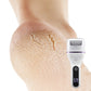 ✨Portable Electric Foot Callus Remover - Quick & Efficient Dead Skin Removal