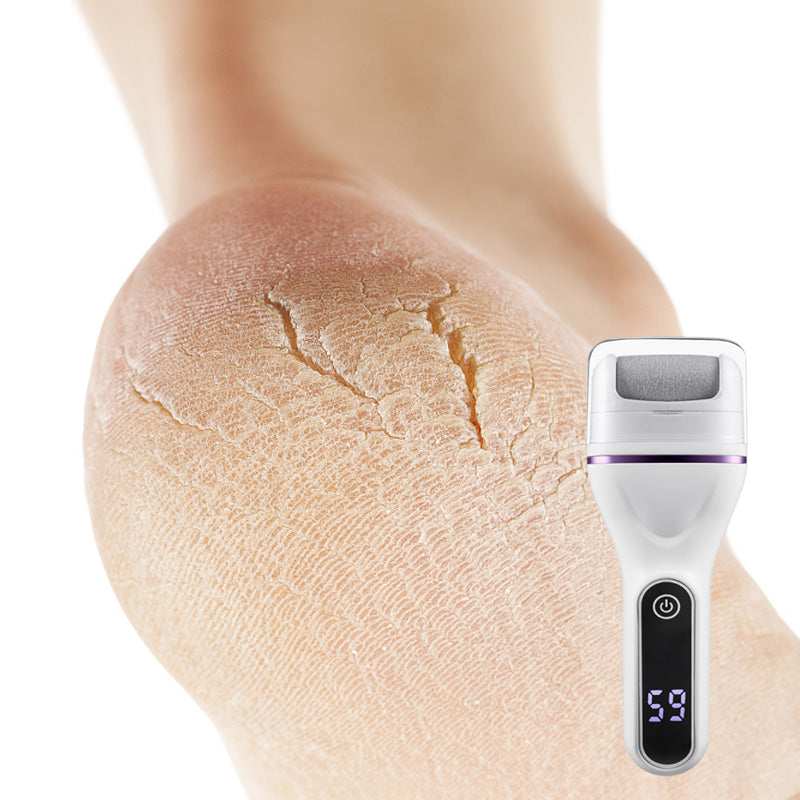 ✨Portable Electric Foot Callus Remover - Quick & Efficient Dead Skin Removal
