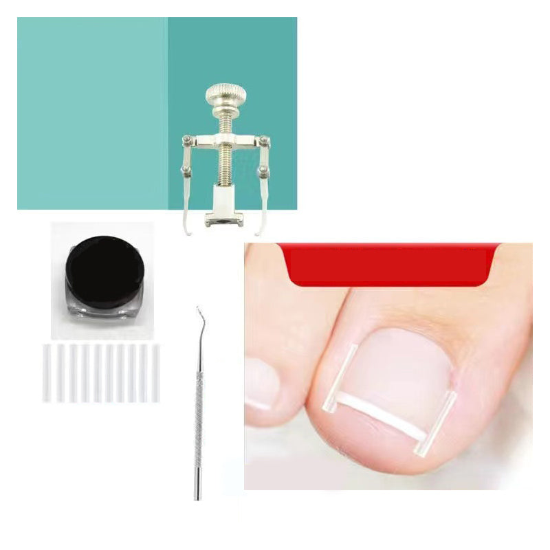 🔥LIMITED OFFER🔥Ingrown Toenail Treatment Corrector Set