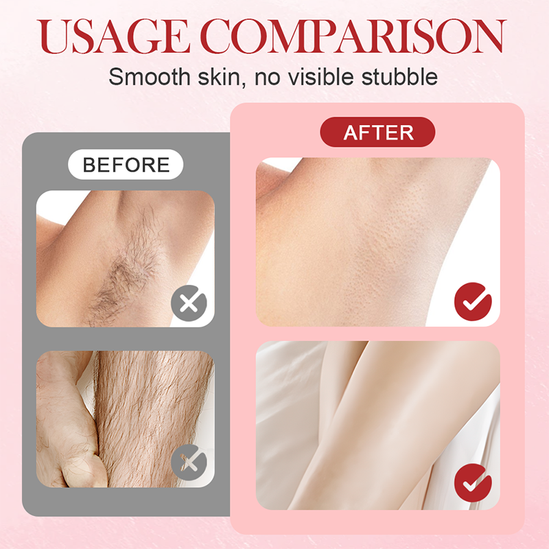 🔥HOT SALE🔥Portable Dual-Head Electric Epilator🍑