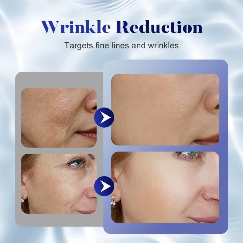 🌟 Ageless Elegance Cream ✨ – Advanced Peptide Formula to Smooth Wrinkles, Firm Skin & Restore Youthful Glow! 🧬✨