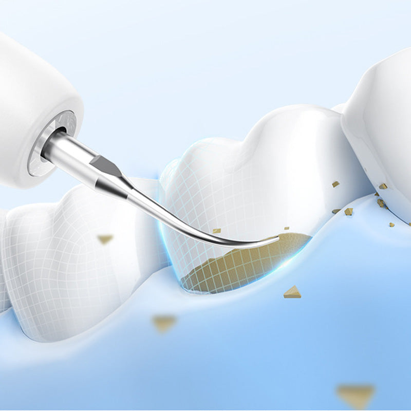 🦷 Ultrasonic Electric Tooth Cleaner - Deep Clean & Whitening at Home Like a Dentist! ✨