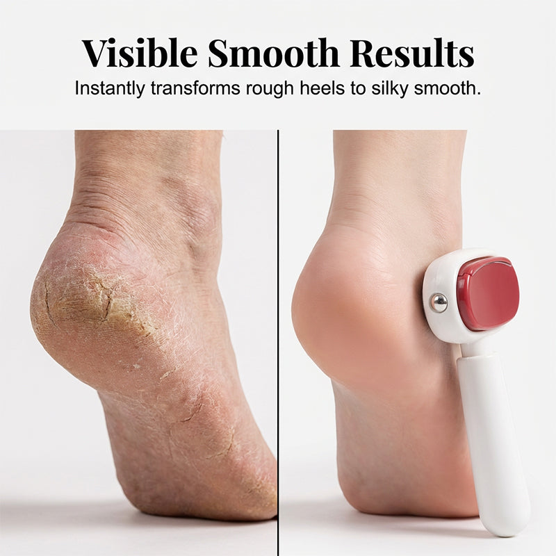 🔥New Arrivals: 55% Off for a Limited Time!🏆Double-Sided Foot Scraper for Callus Removal