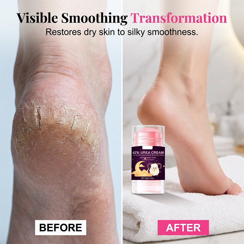Heel Repair Salicylic Acid Cream
